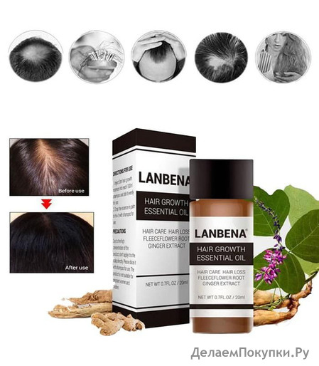     Lanbena Hair Growth Essential Oil, 20 