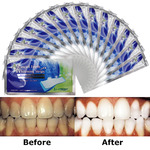     ADVANCED TEETH WHITENING STRIPS